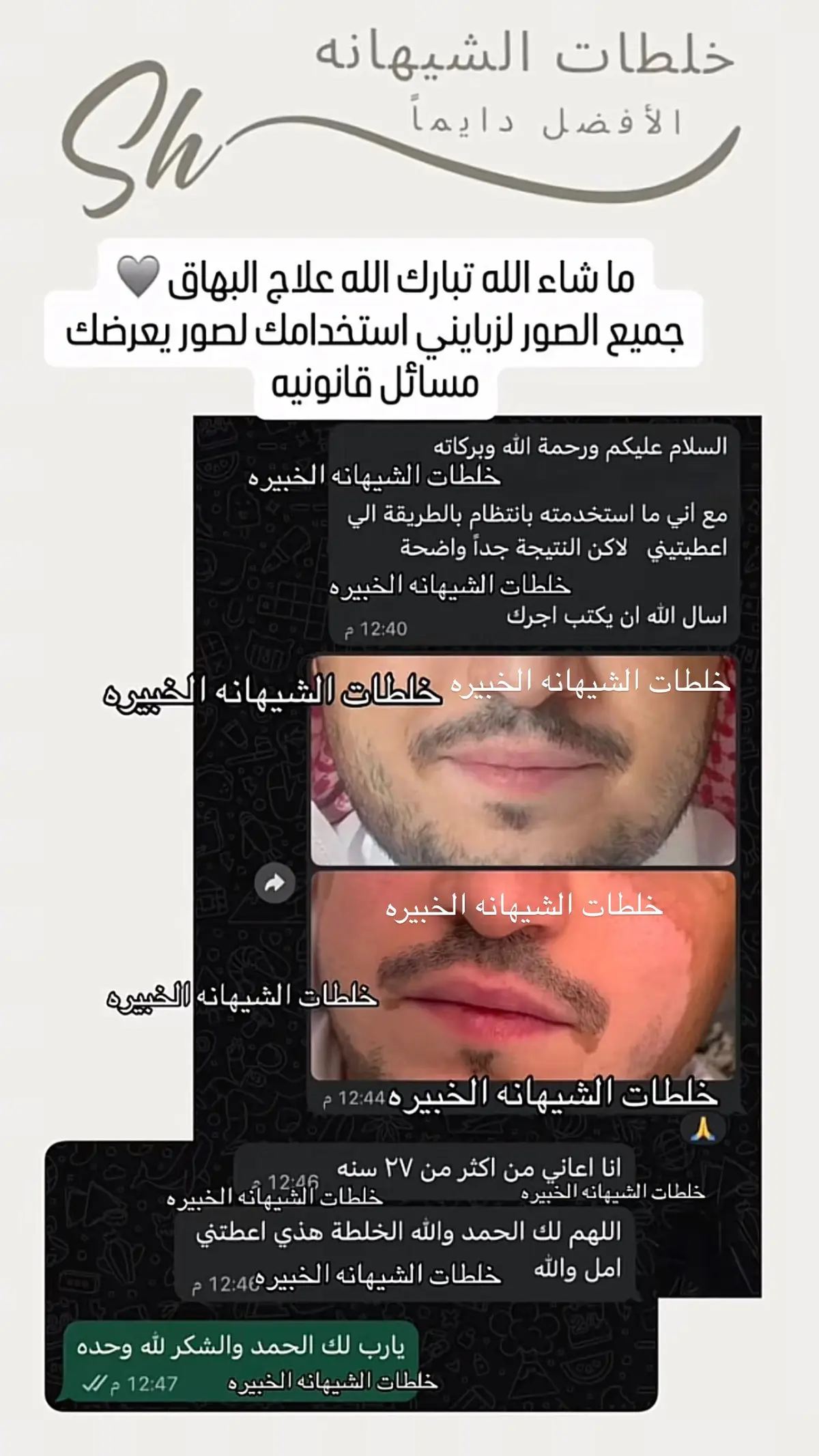 كريم البهاق ، الشيهانه الخبيره🥇