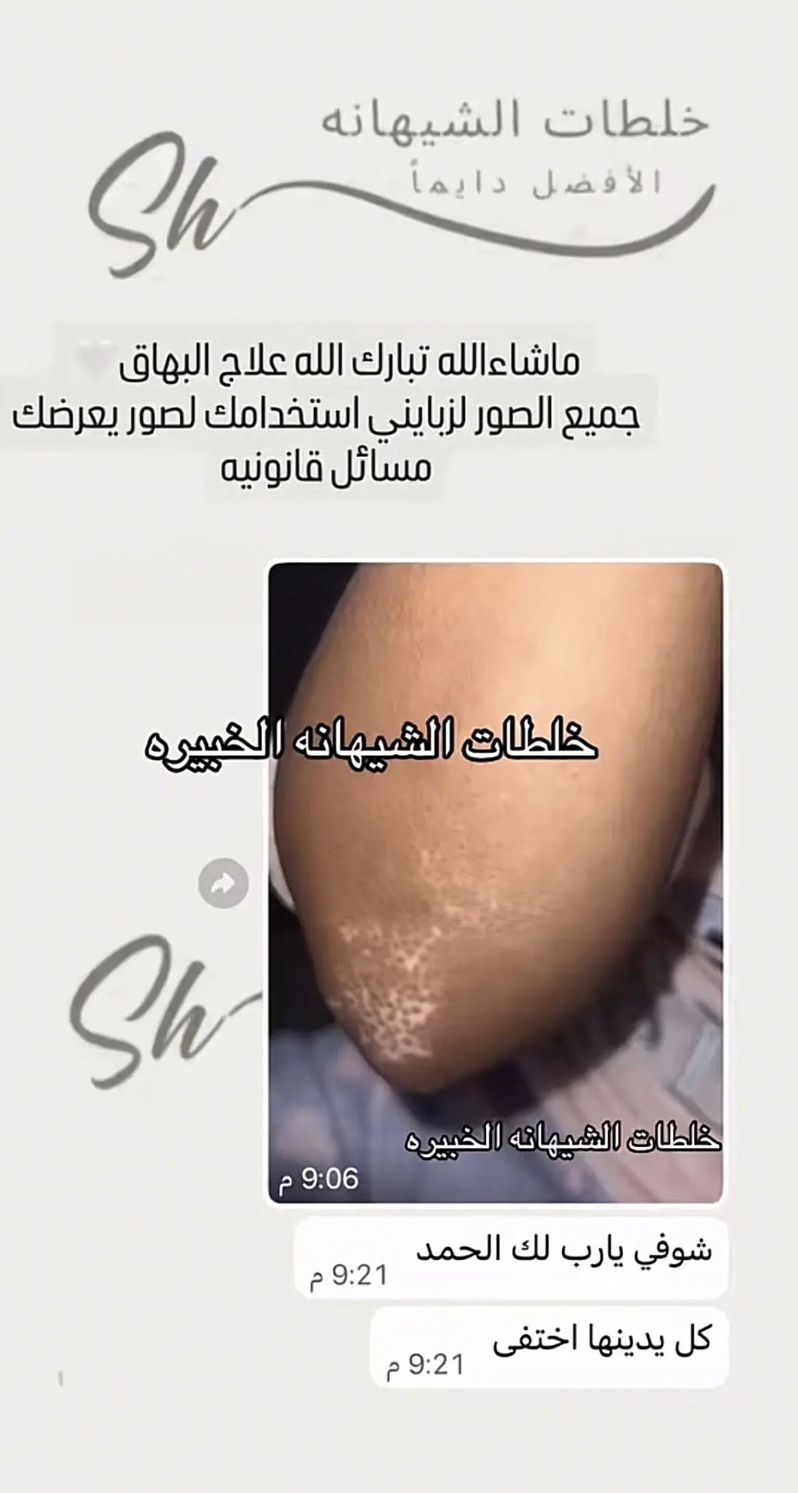 كريم البهاق ، الشيهانه الخبيره🥇