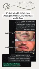 كريم البهاق ، الشيهانه الخبيره🥇