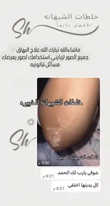كريم البهاق ، الشيهانه الخبيره🥇